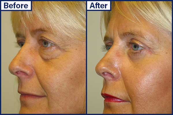 before-and-after-6